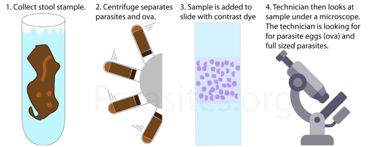 picture of the ova parasite stool test product