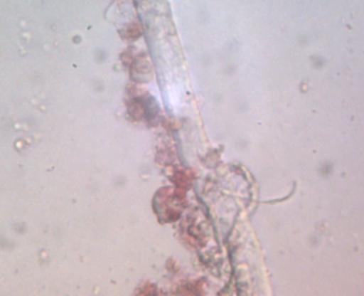 Larval nematode at 50 times magnification.