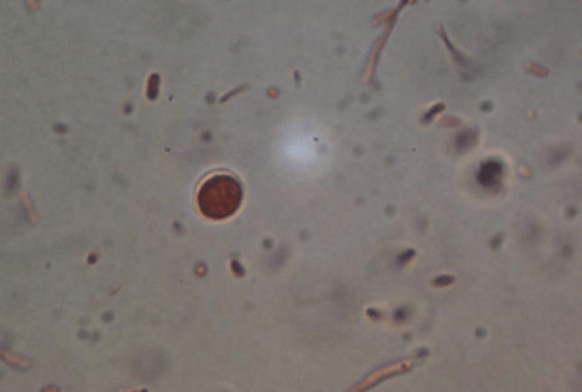 Cryptosporidium Parvum at 1000 times magnification.