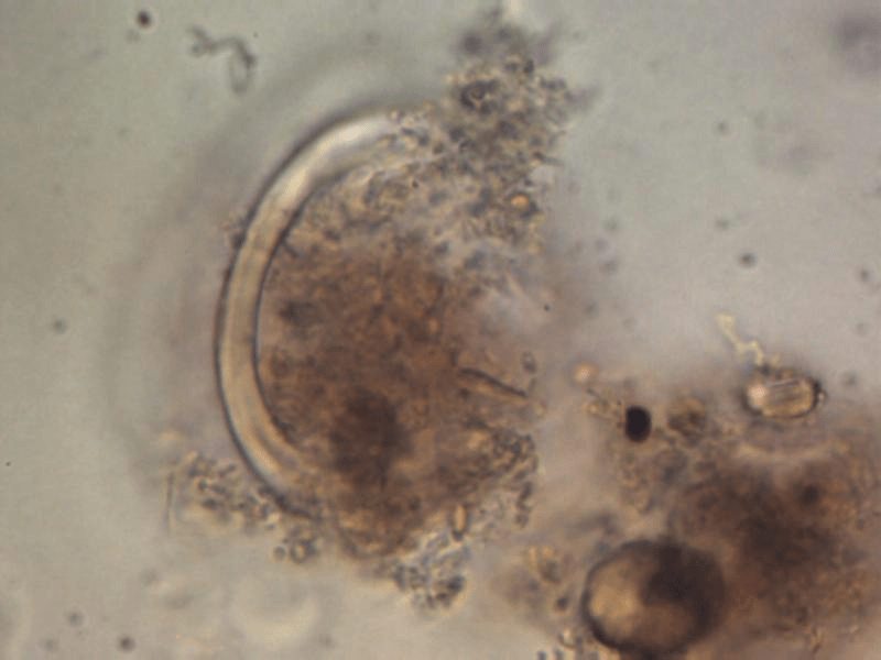 1000 times magnification Ascaris lumbricoides egg, found with Ova and Parasite Examination.