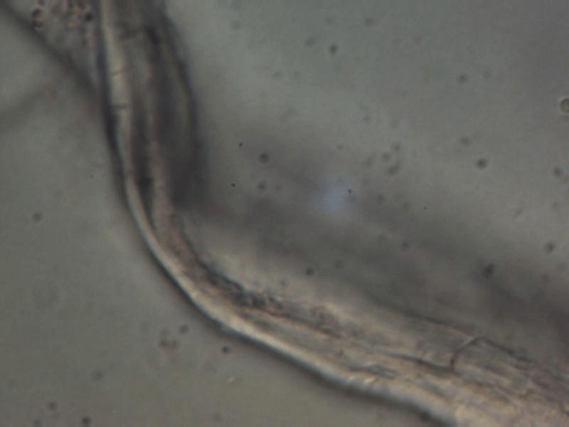 Larval Nematode 1000 magnification found in urine parasite analysis.