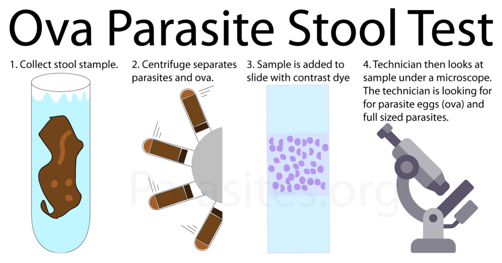 image of the ova parasite stool test step by step process